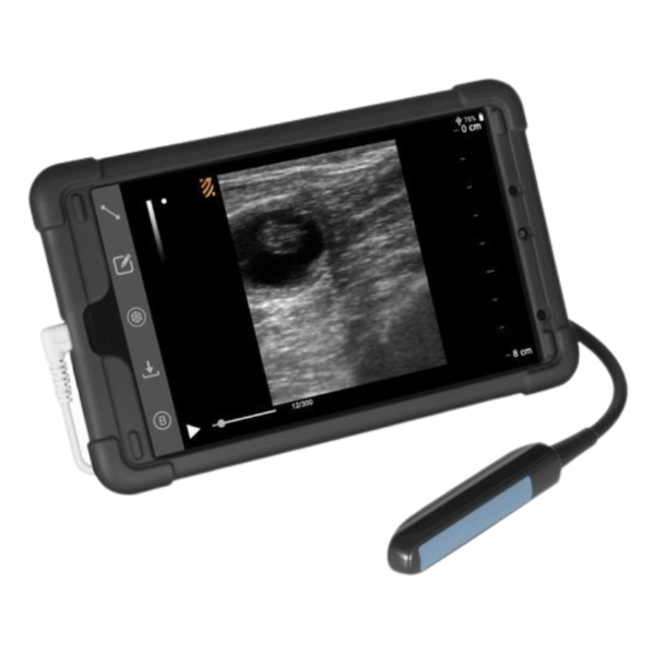 Ecógrafo portátil BestScan S5 GO | Excepcional solución ultrasónica portátil para el diagnóstico reproductivo | Marca: BMV | Incluye transductor lineal rectal