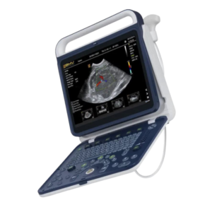 Ecógrafo portátil BPU60 | Ecógrafo portátil con imagen Doppler e 2D imagen en tiempo real | Marca: BMV | Incluye transductor convexo y lineal