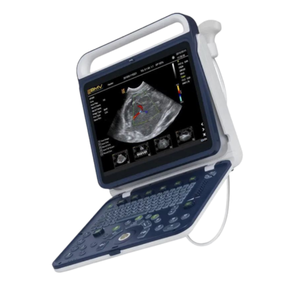 Ecógrafo portátil BPU60 | Ecógrafo portátil con imagen Doppler e 2D imagen en tiempo real | Marca: BMV | Incluye transductor convexo y lineal